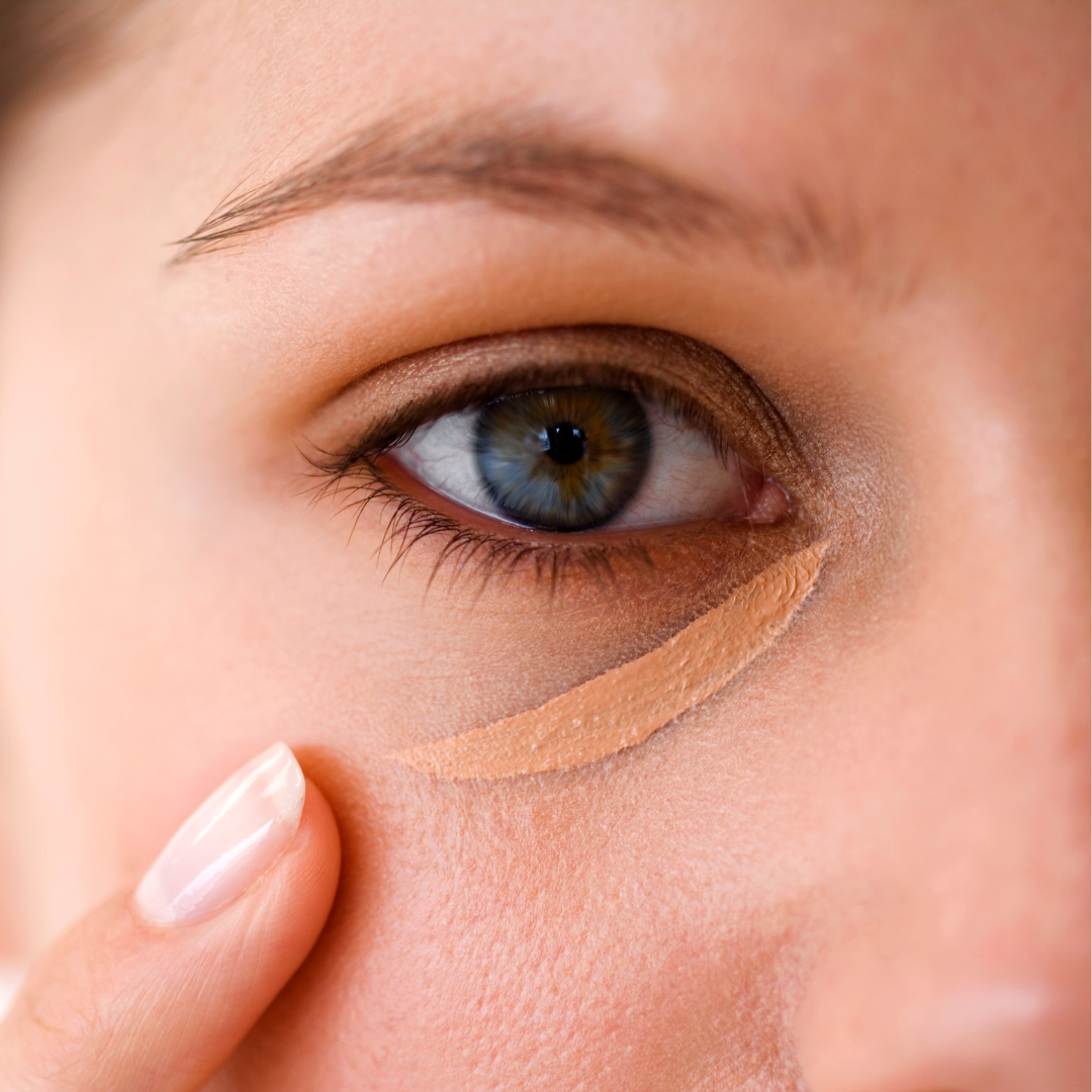 Find the Root Cause to Dark Under-Eye Circles