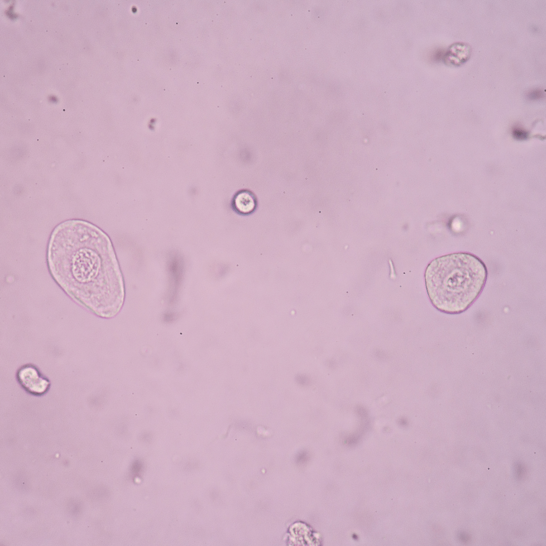 Urinary Health